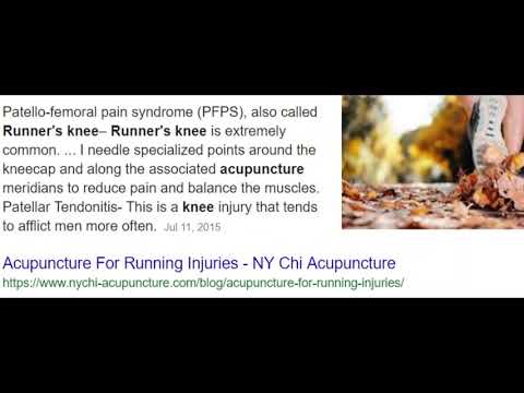 About Arthritis acupuncture