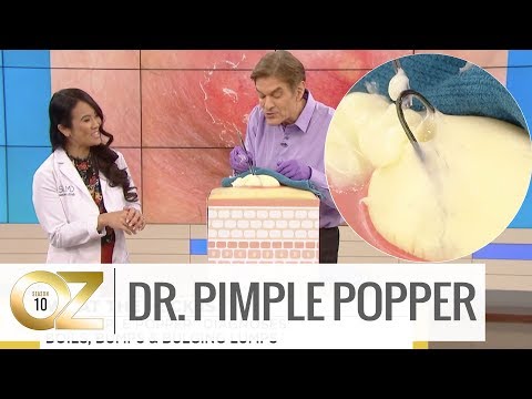 Dr. Pimple Popper Demonstrates How to Remove an Ingrown Hair